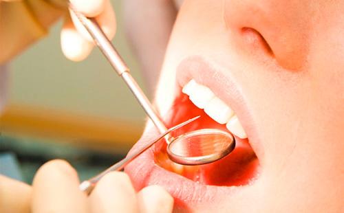 Liječenje kod stomatologa