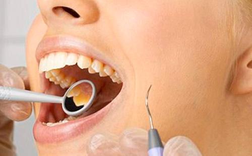 Zubno izbjeljivanje