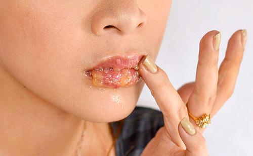 Girl lubricates her lips with honey