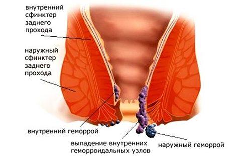 Schematic representation of the disease
