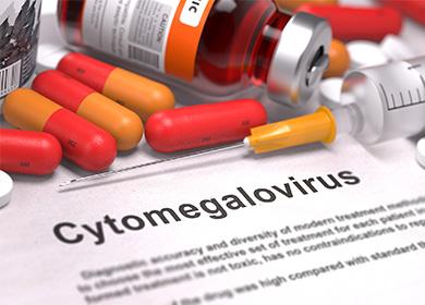 La inscripción citomegalovirus y pastillas sobre la mesa