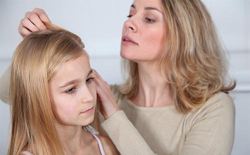 Mom chooses lice for daughter