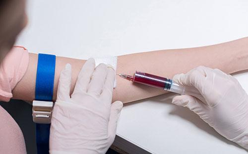 Blood test from a vein